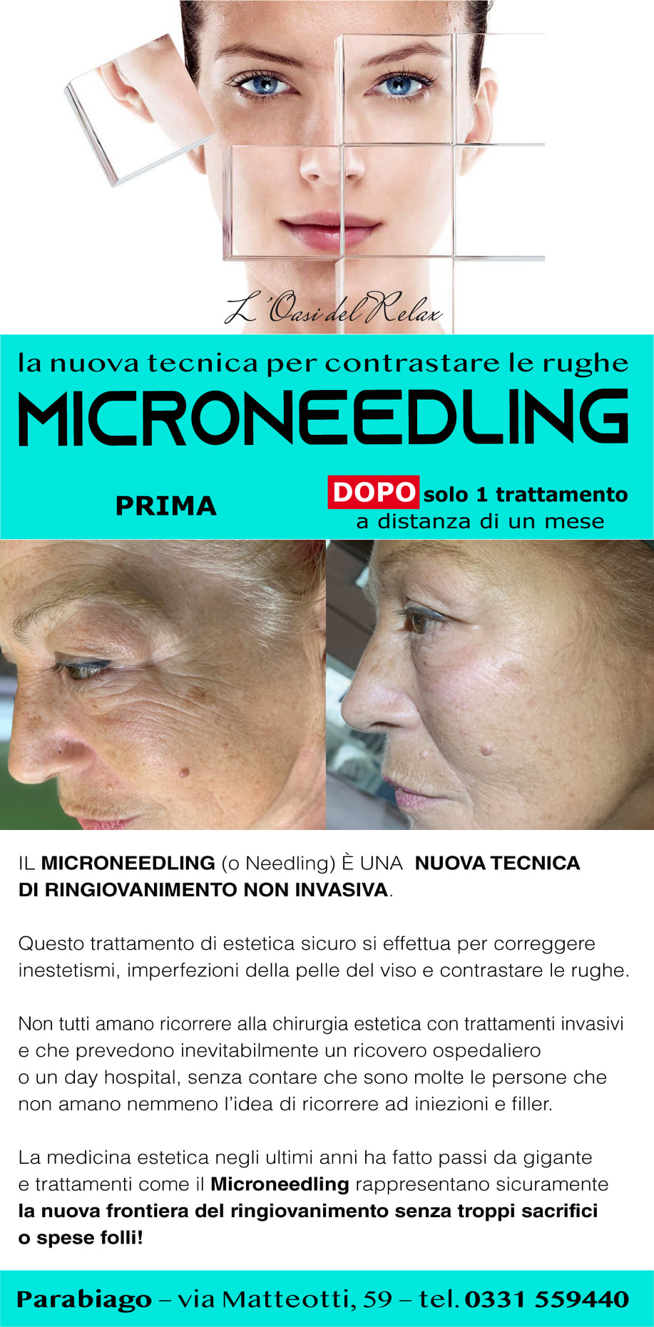 oasi del relax parabiago eventi prova gratuita MICRONEEDLING